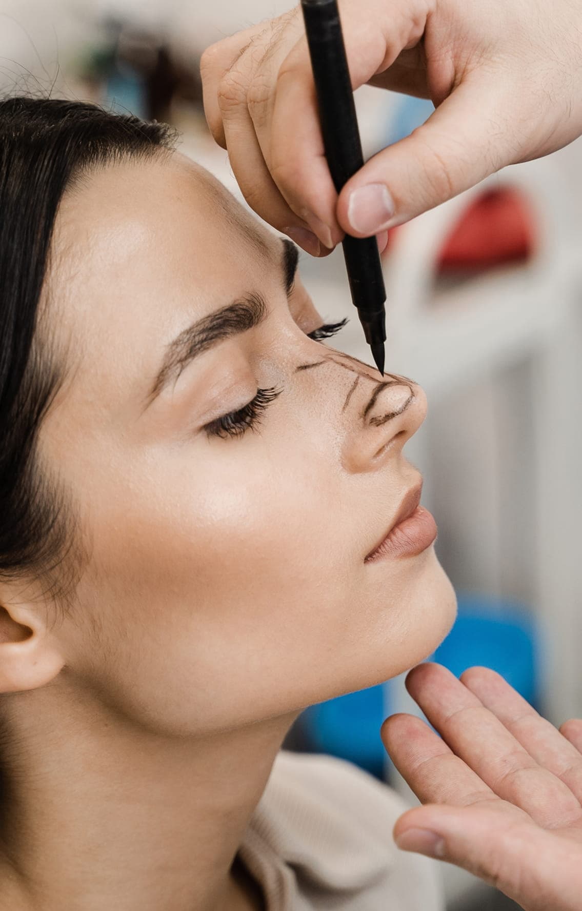 Rhinoplasty